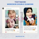 Testimoni Moreskin Double Diamond Skin 2